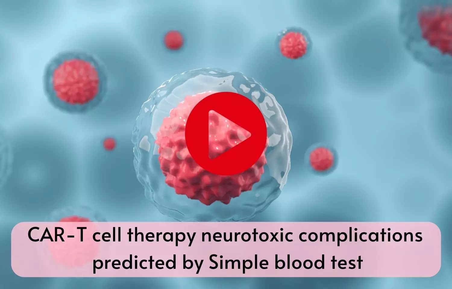 CAR-T cell therapy neurotoxic complications predicted by Simple blood test