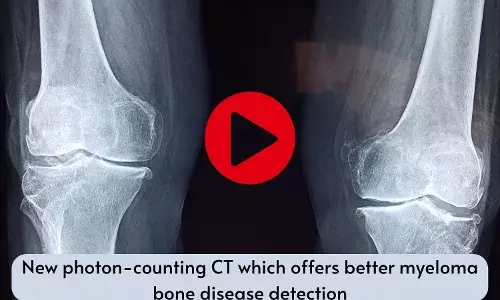New photon-counting CT which offers better myeloma bone disease detection