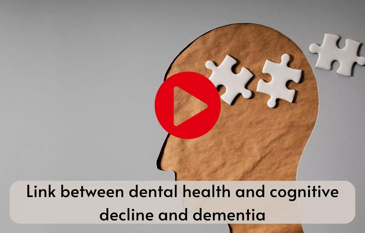 Link between dental health and cognitive decline and dementia?