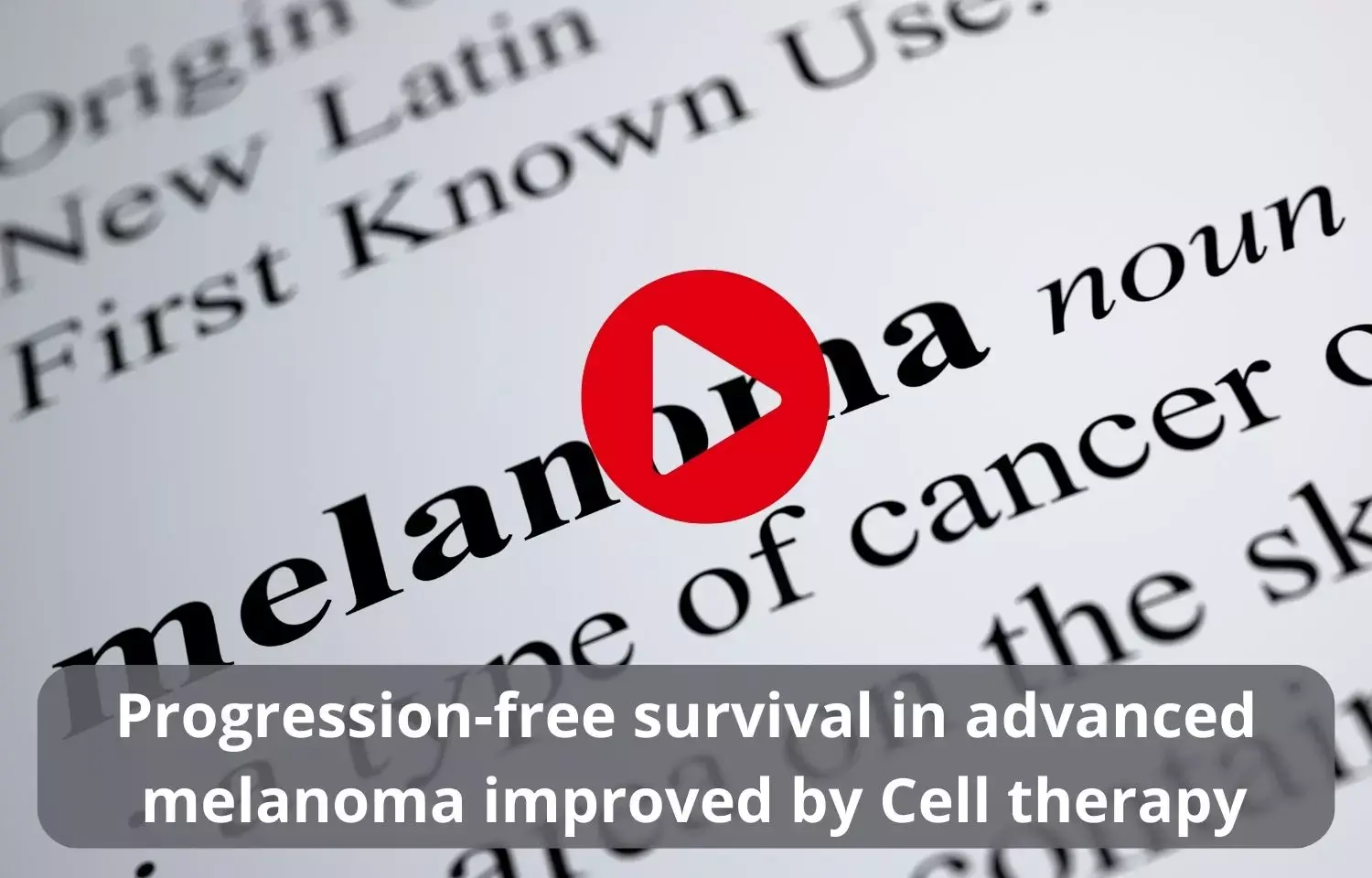 Progression-free survival in advanced melanoma improved by Cell therapy