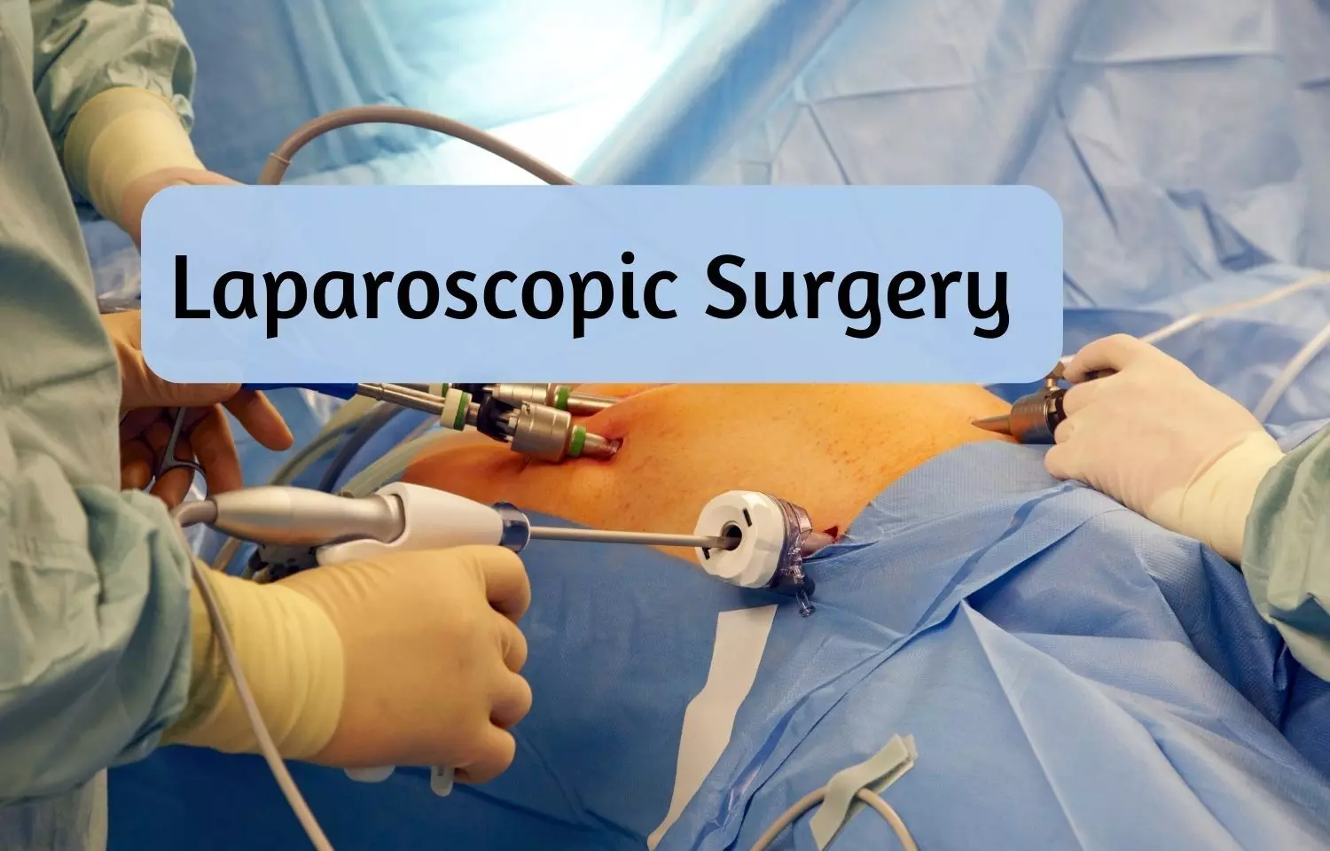First: 3D 4K Aided Laparoscopic Surgery live transmitted from Sir Ganga Ram Hospital to conference