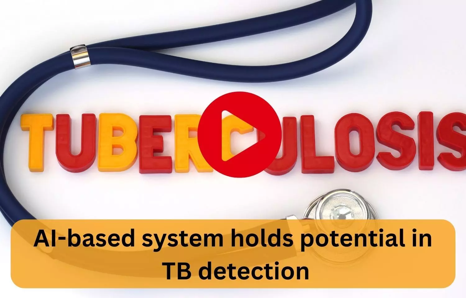 AI-based system holds potential in TB detection