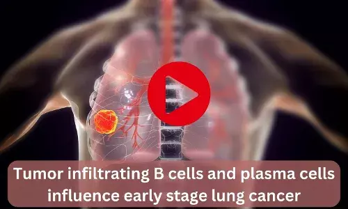 Tumor-infiltrating B cells and plasma cells influence early-stage lung cancer