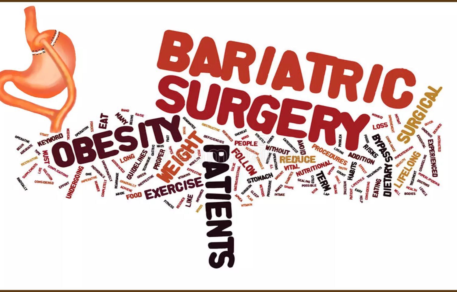 How Long Do Gas Pains Last After Bariatric Surgery