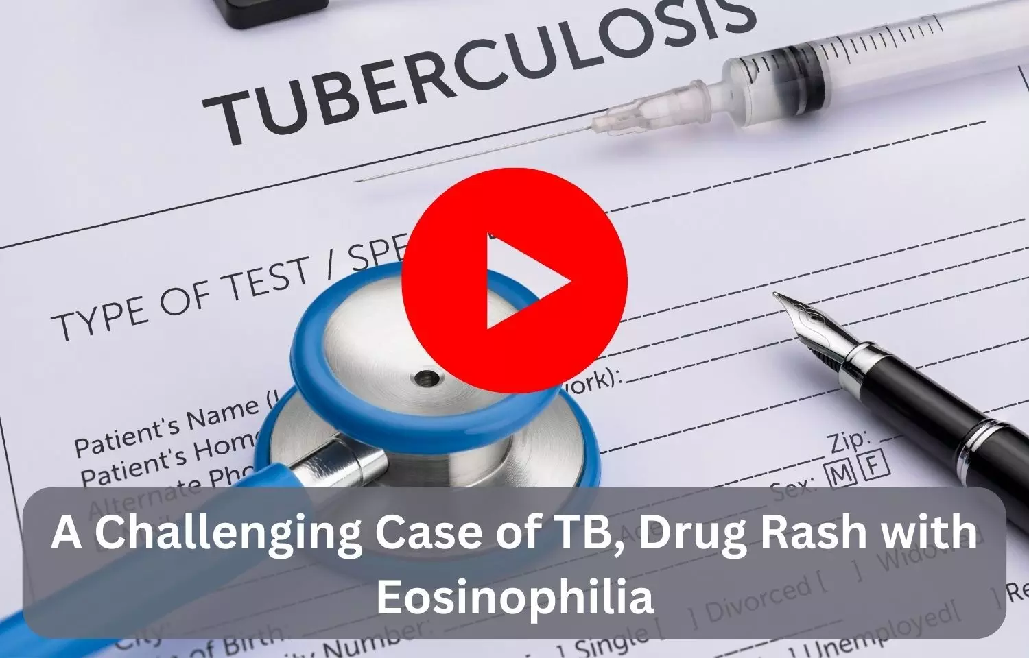 A Challenging Case of TB, Drug Rash with Eosinophilia