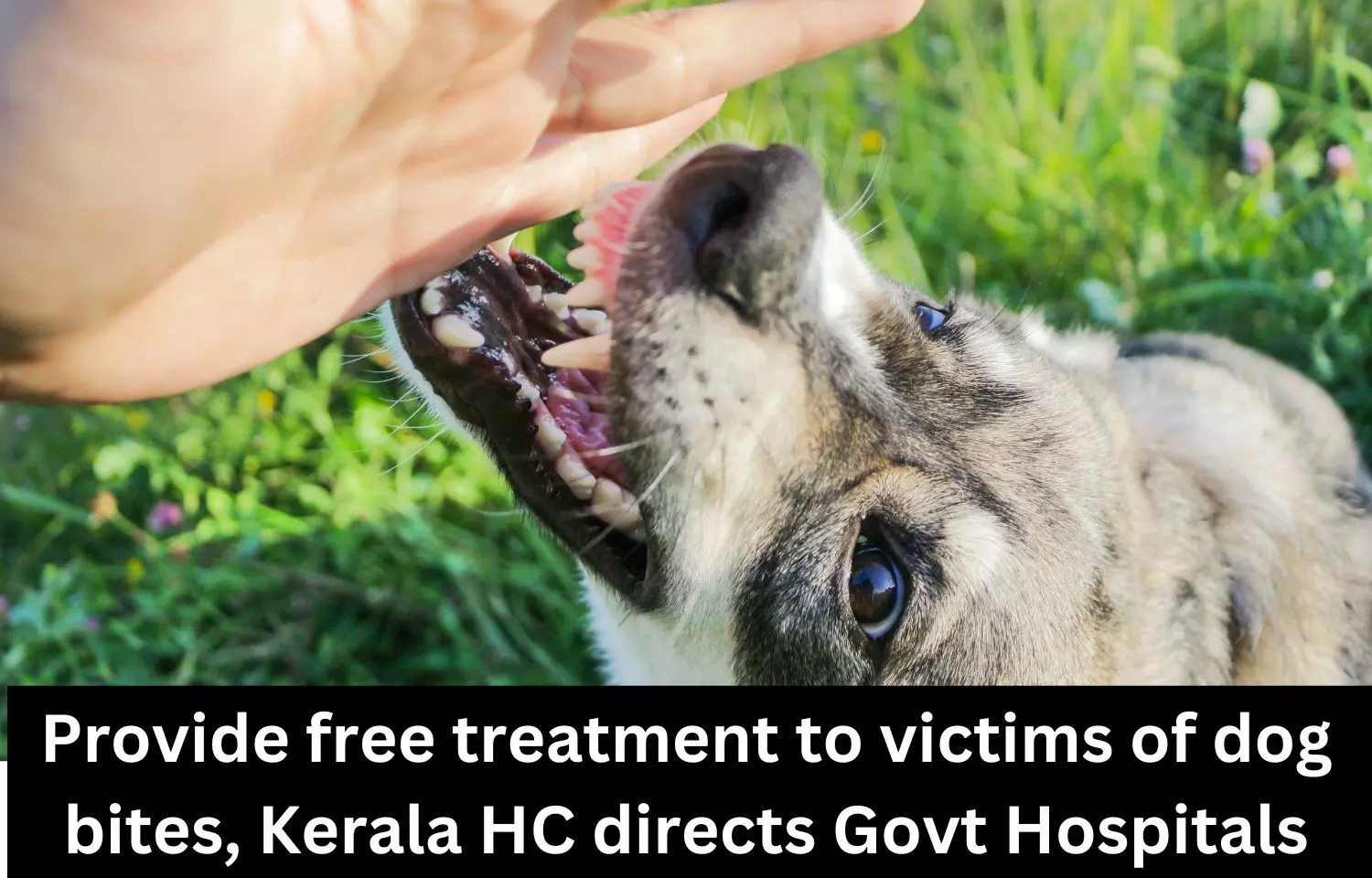 Kerala HC directs Govt Hospitals to provide free treatment to victims of dog bites