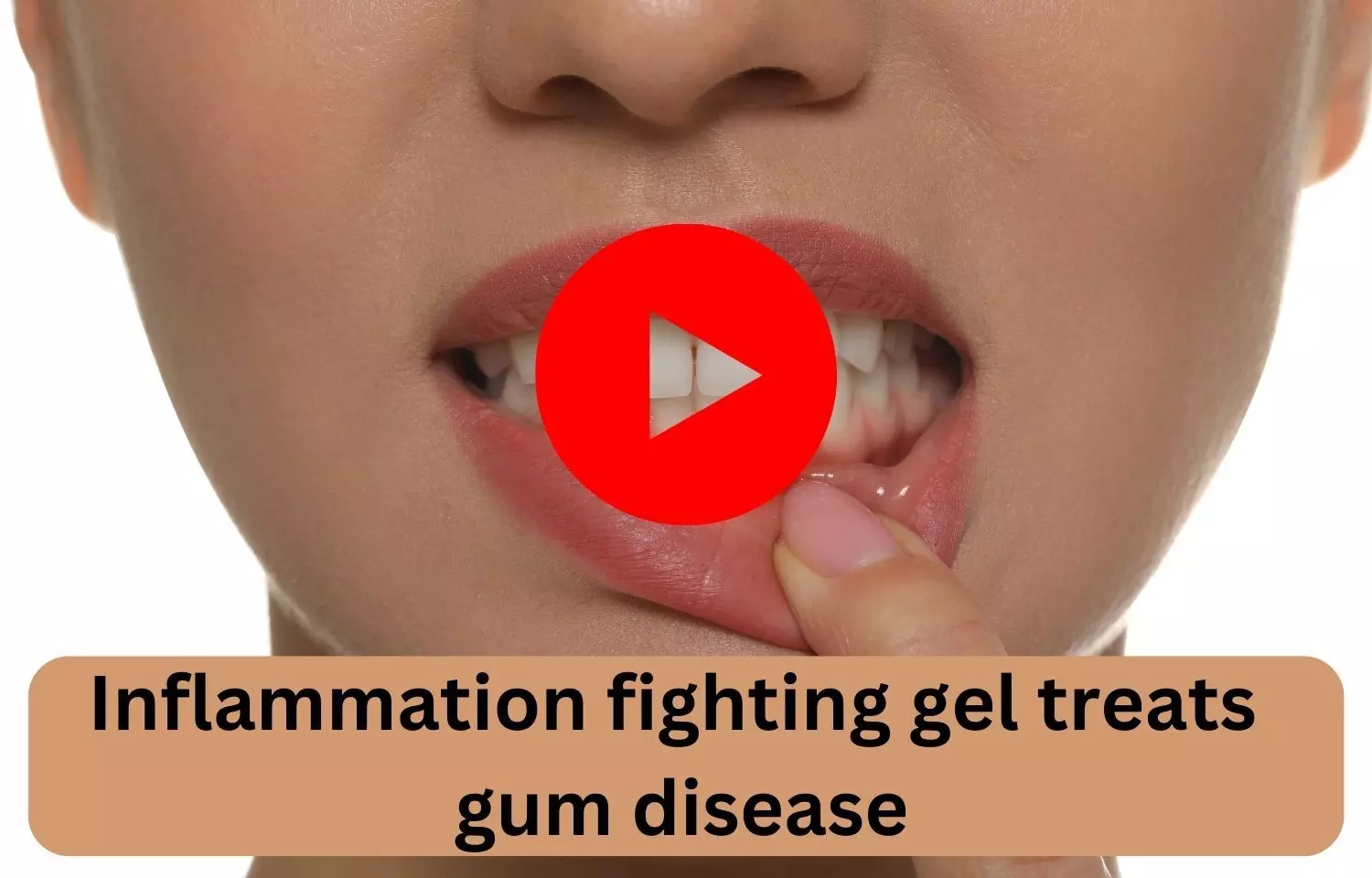 Inflammation fighting gel treats gum disease