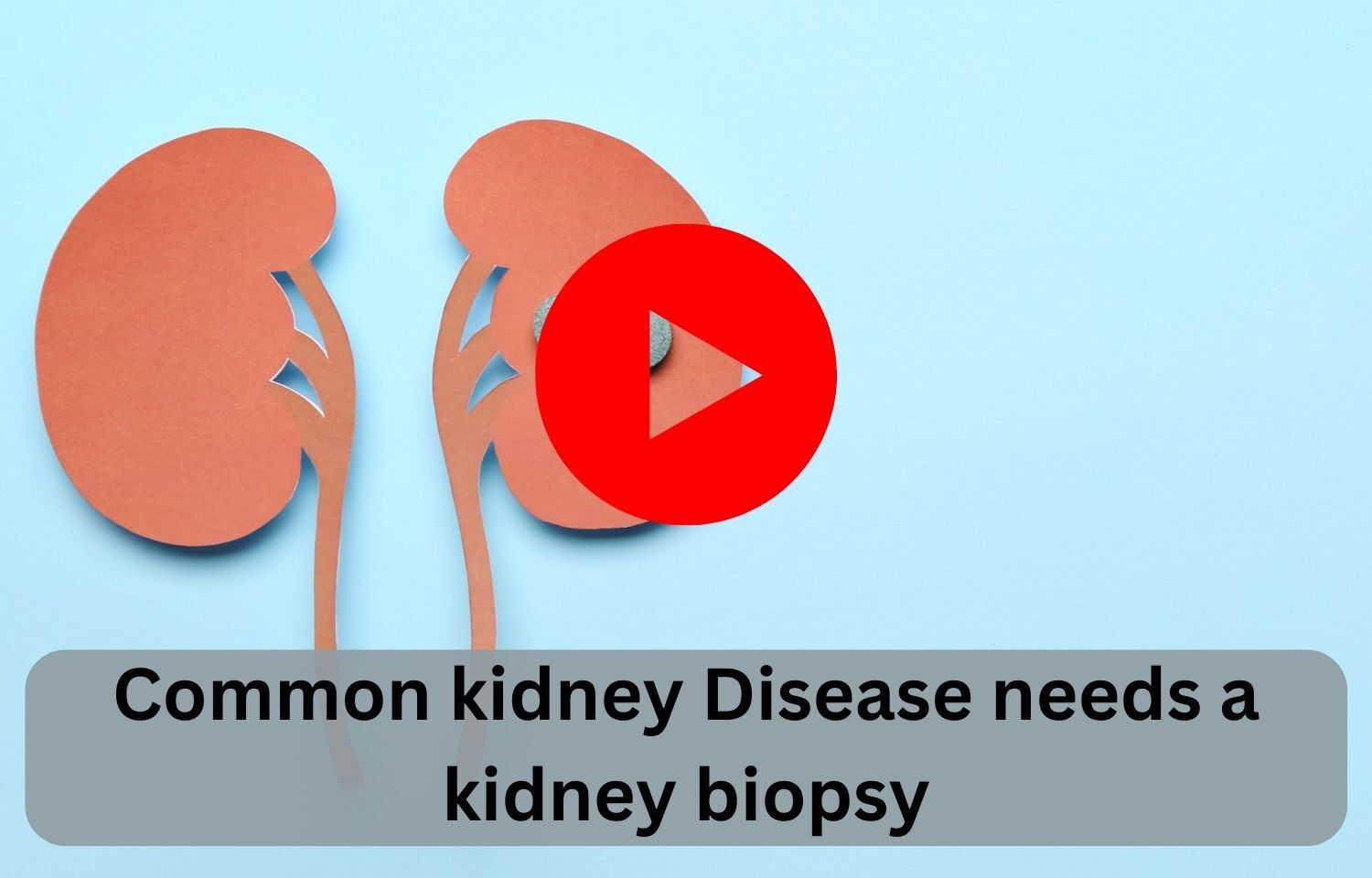 Common kidney Disease needs a kidney biopsy?