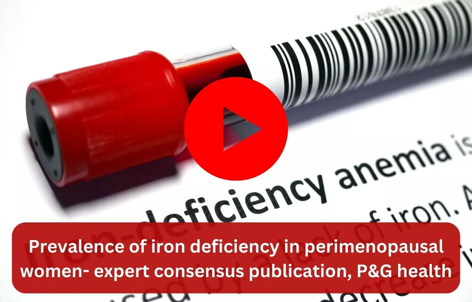 Prevalence of iron deficiency in perimenopausal women-Expert consensus publication, P&G health