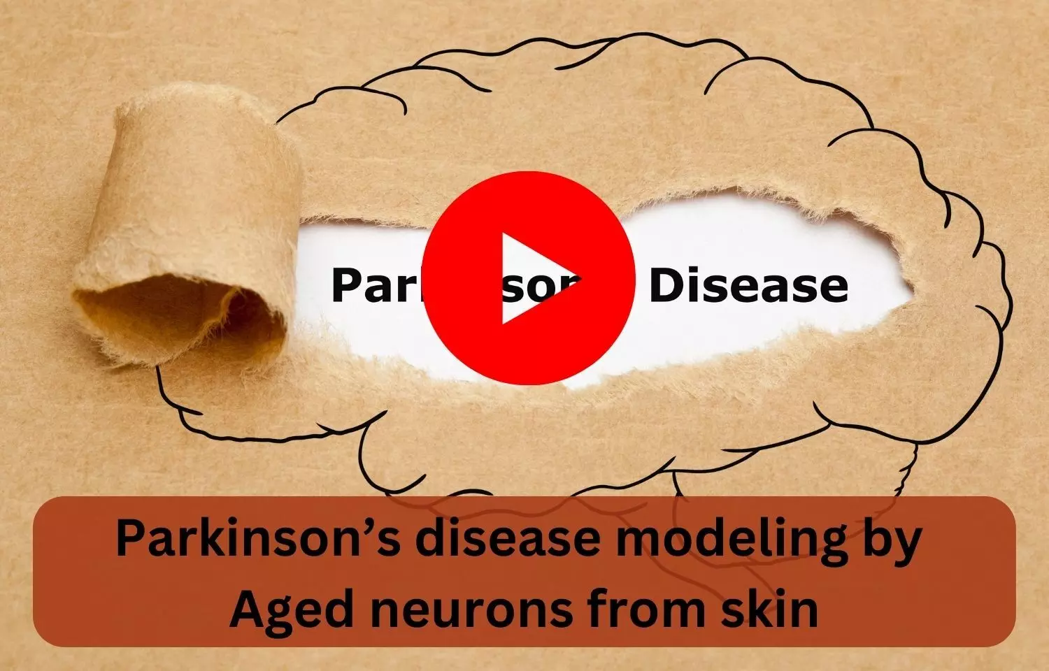 Parkinsons disease modeling by Aged neurons from skin