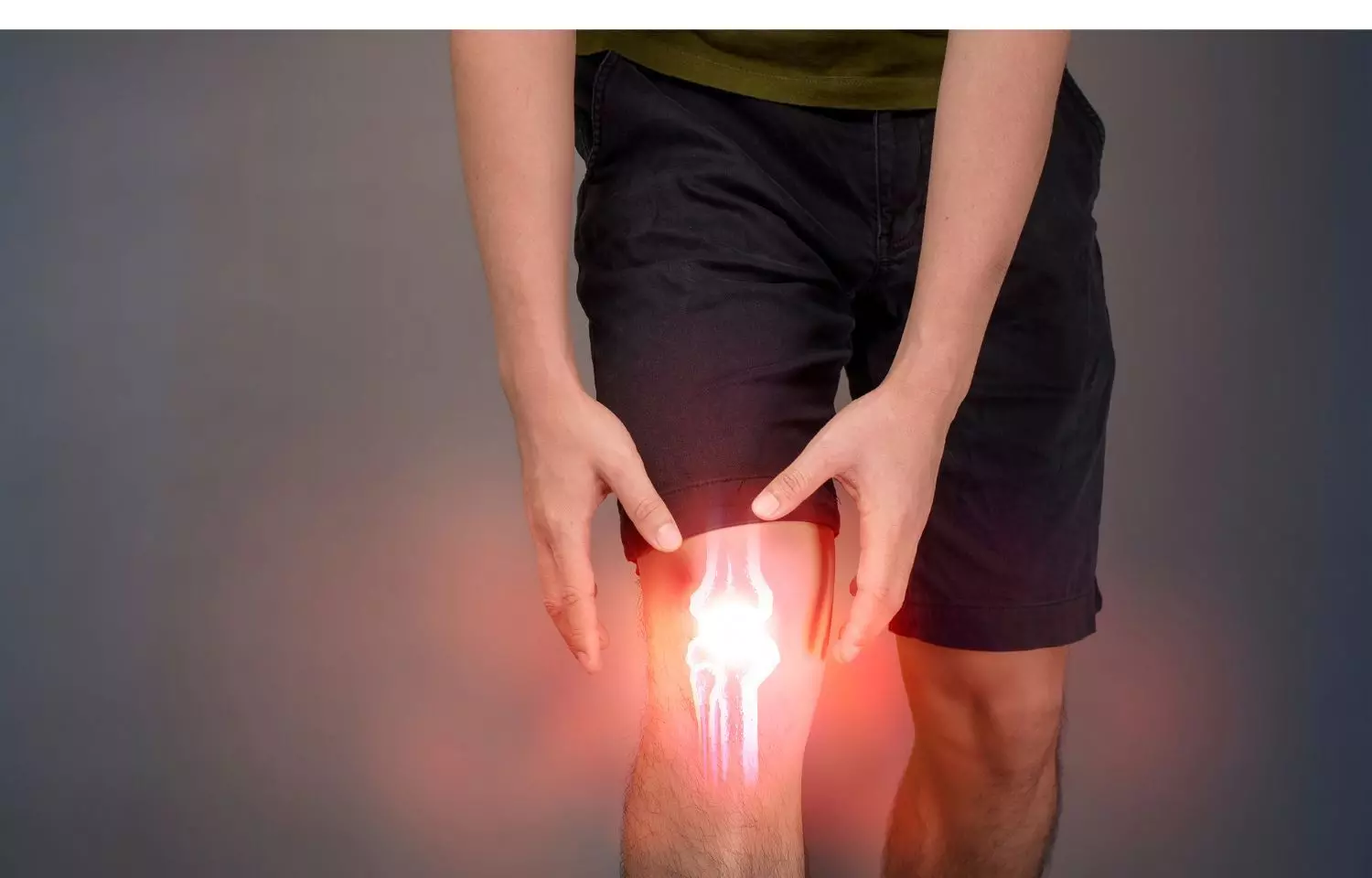 New implantable shock absorber relieves pain, delays knee replacement in osteoarthritis patients