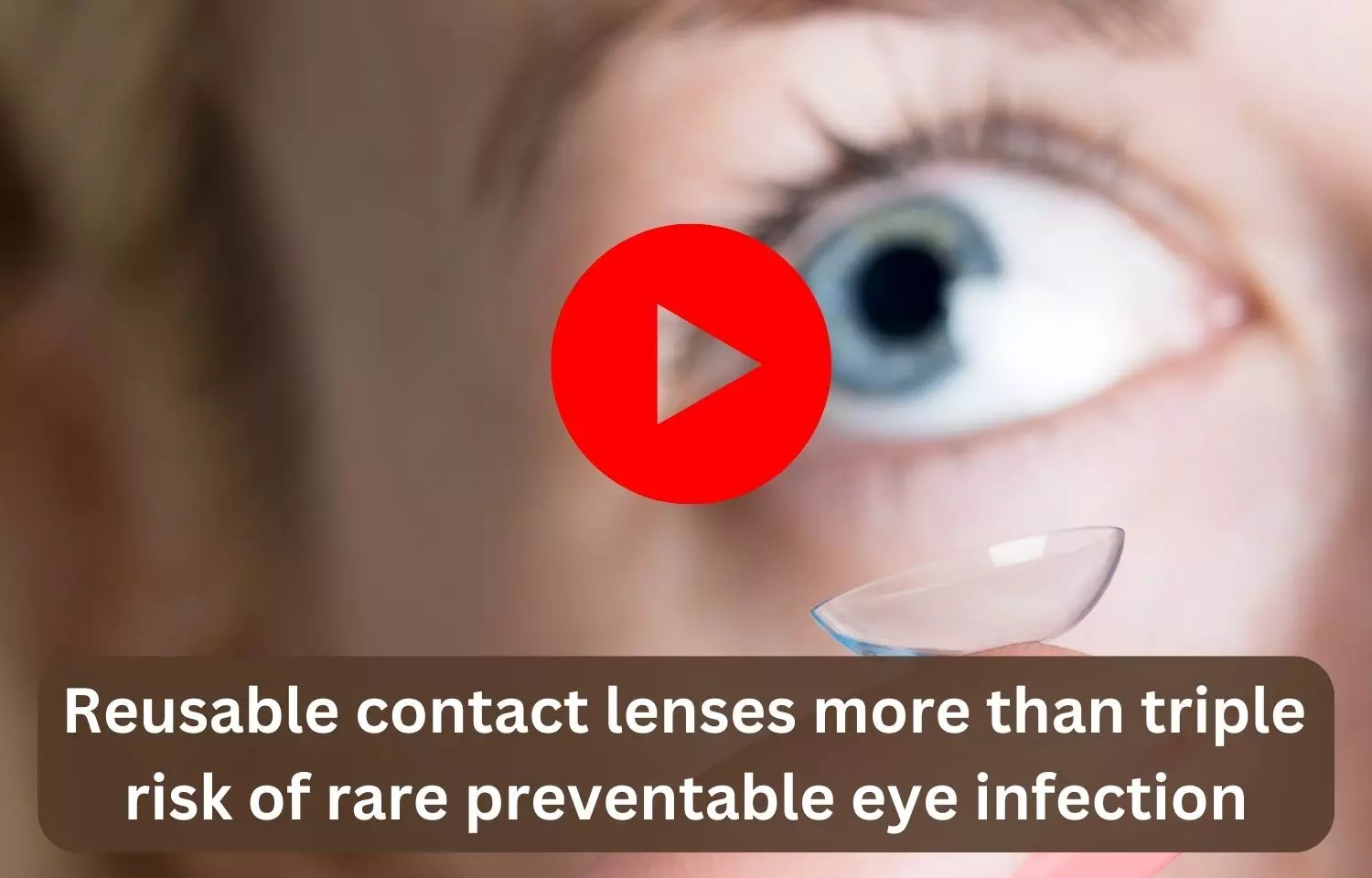 Reusable contact lenses more than triple risk of rare preventable eye infection