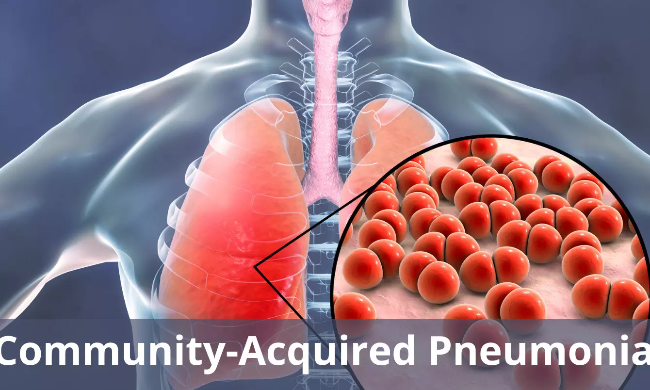 Nomogram may predict   Community-acquired pneumonia in Diabetics