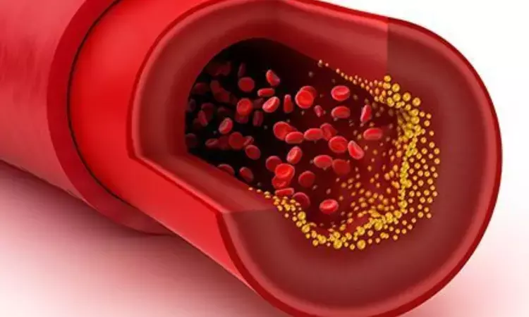 Alogliptin decreases coronary plaque volume in ACS patients with dysglycemia
