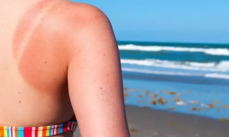 Super melanin heals skin wounds caused by sunburn, chemical burns