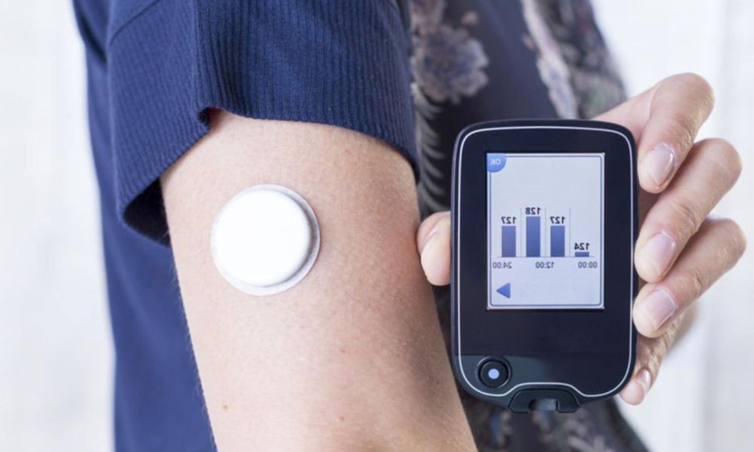 uitbreiden journalist Geef energie Flash glucose monitoring effective strategy for monitoring blood sugar in  diabetes patients, study suggests