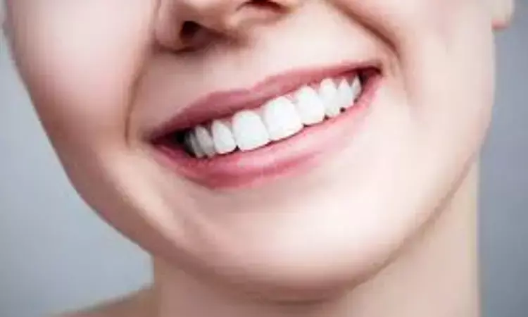 Maxillary posterior gingiva and teeth displayed influence smile attractiveness: study