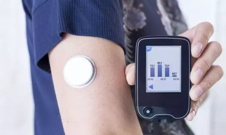 Flash glucose monitoring effective strategy for monitoring blood sugar in diabetes patients, study suggests