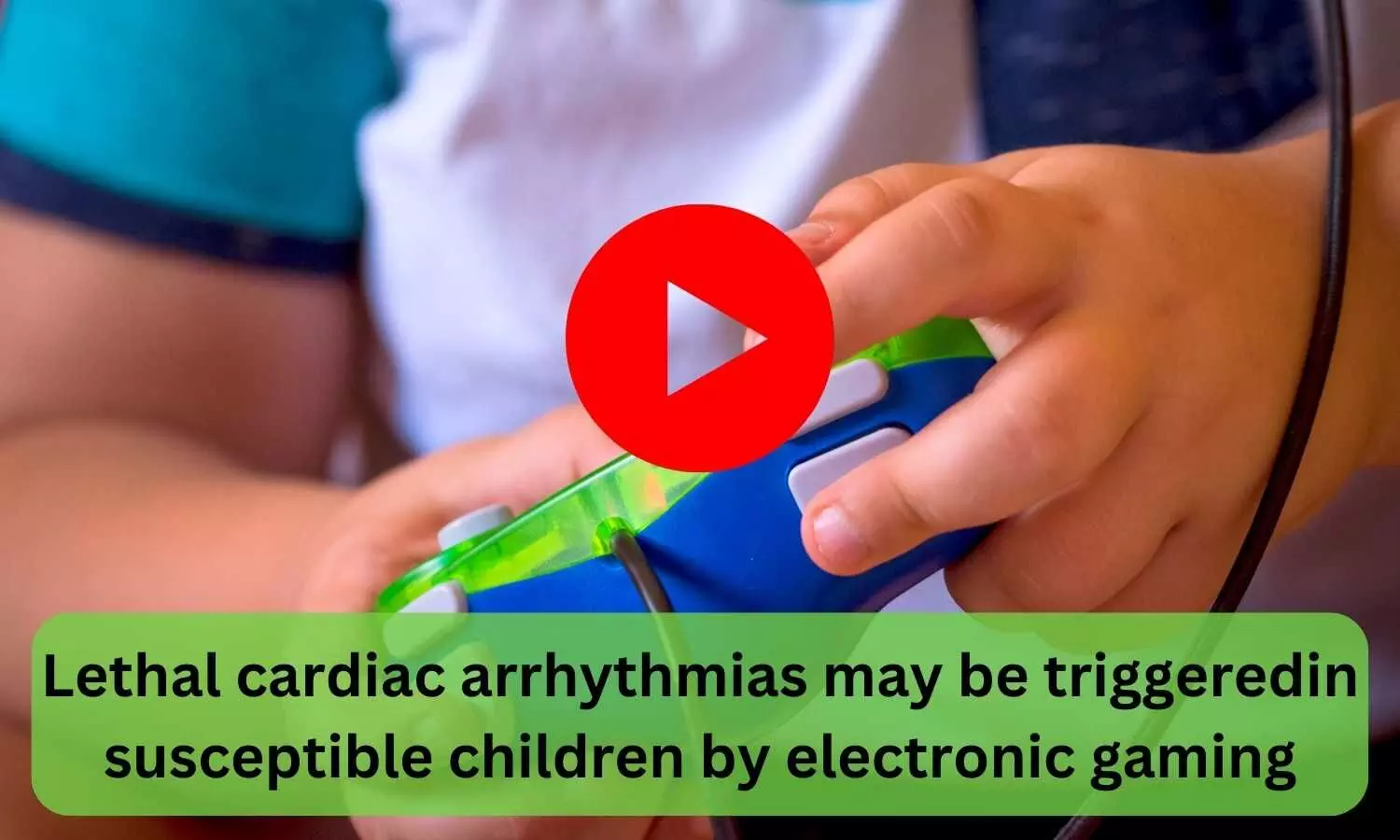 Lethal cardiac arrhythmias may be triggered in susceptible children by electronic gaming