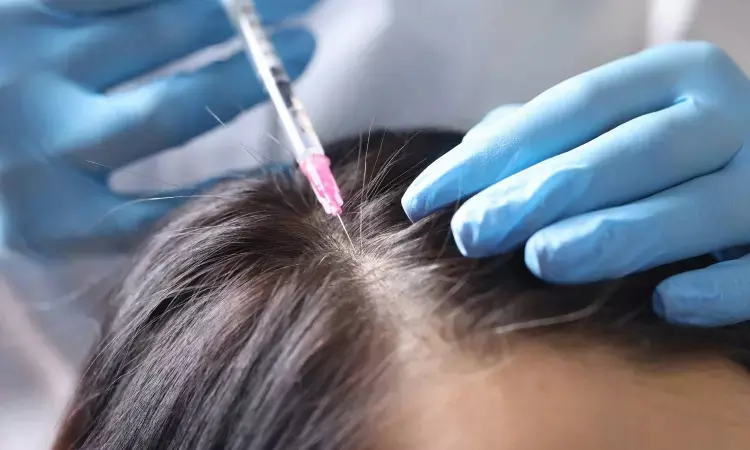 Skin-stretching device an innovative and efficient method for treating large scalp wounds