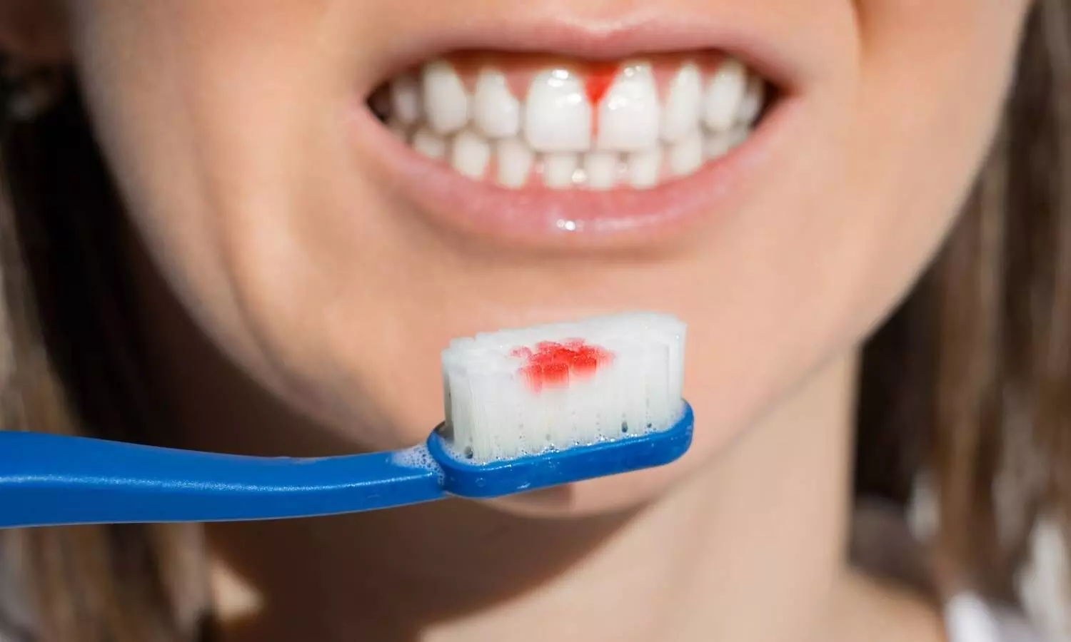 New device may make accurate assessment of both presence and extent of gum disease