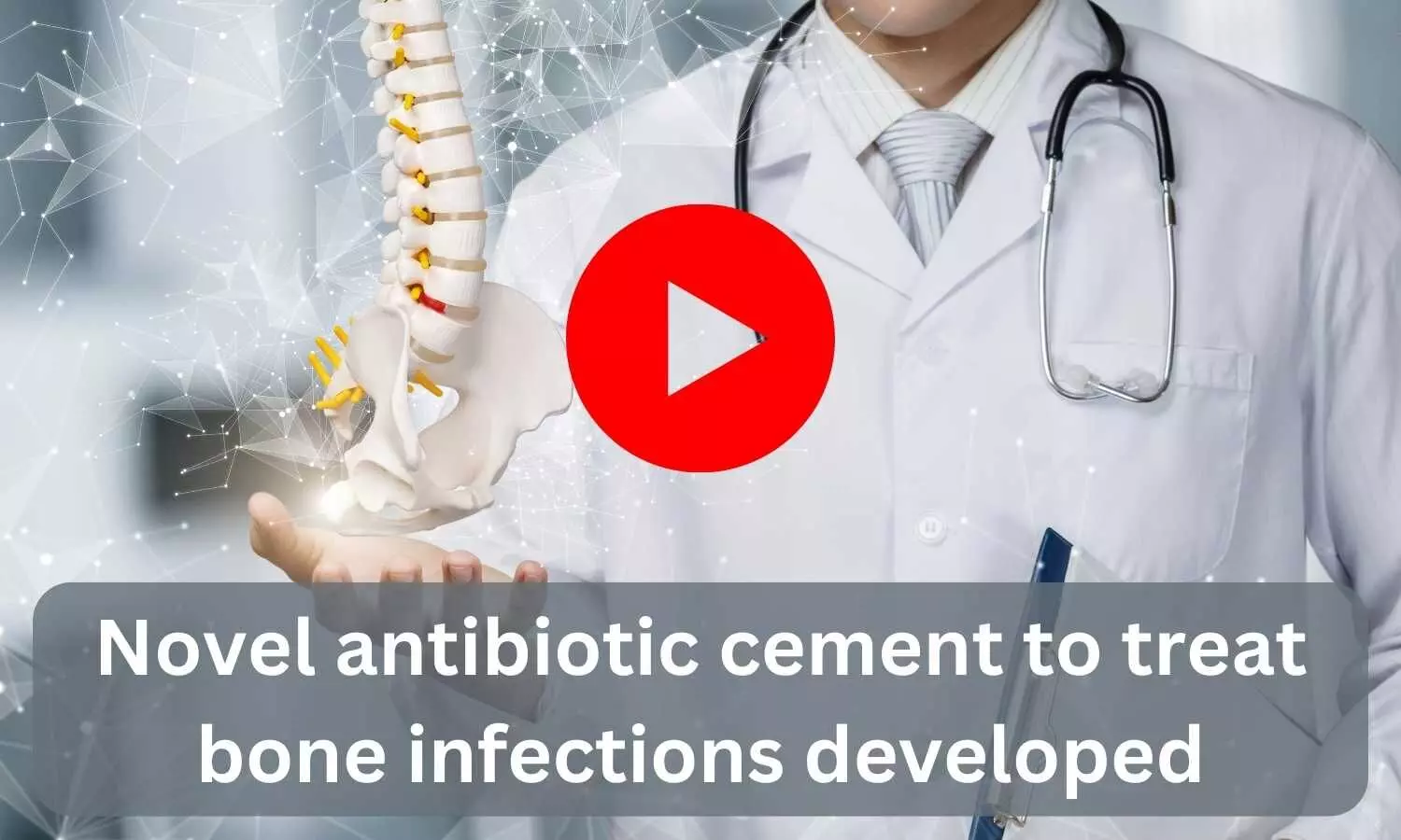 Novel antibiotic cement to treat bone infections developed