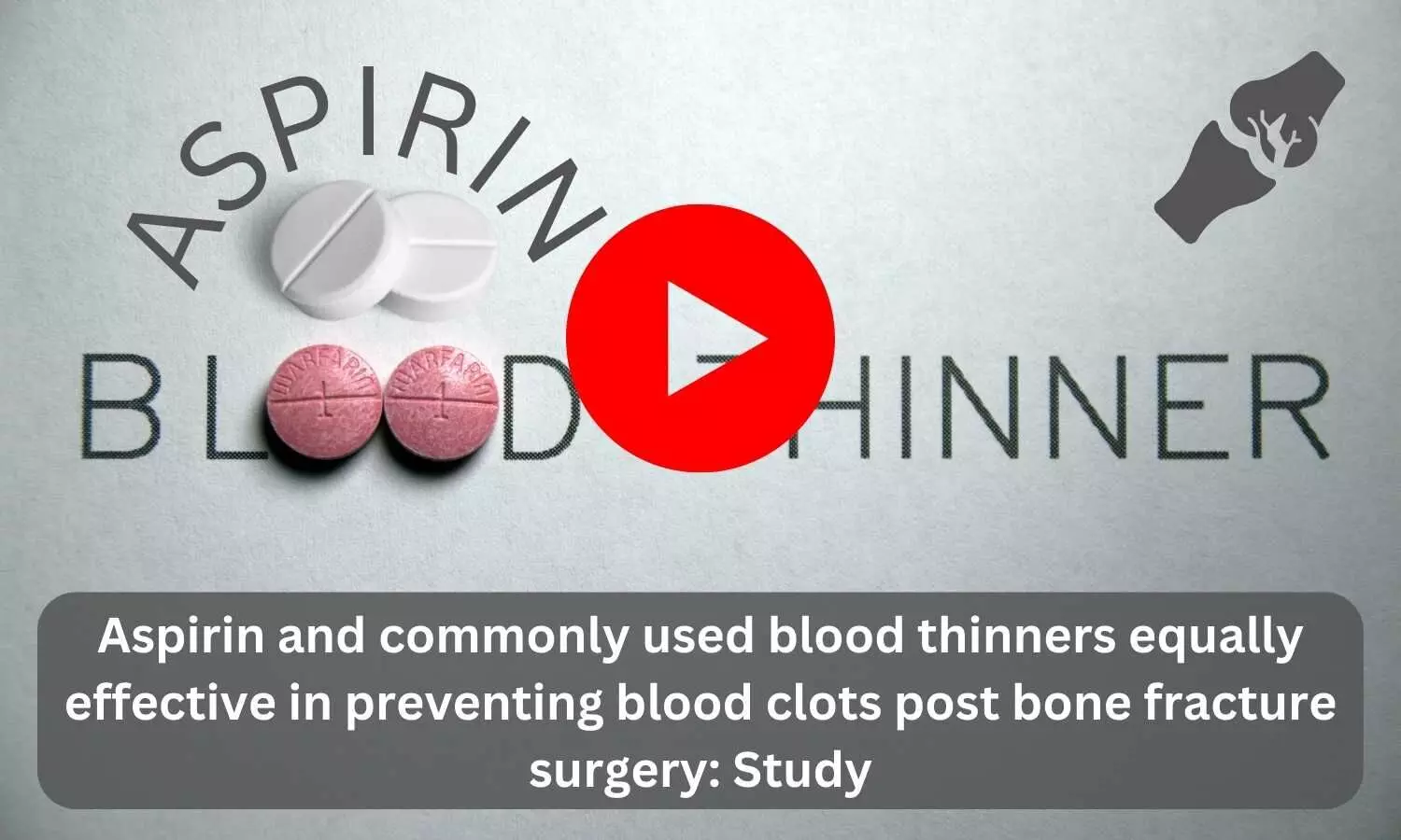 Aspirin and commonly used blood thinners equally effective in preventing blood clots post bone fracture surgery: Study