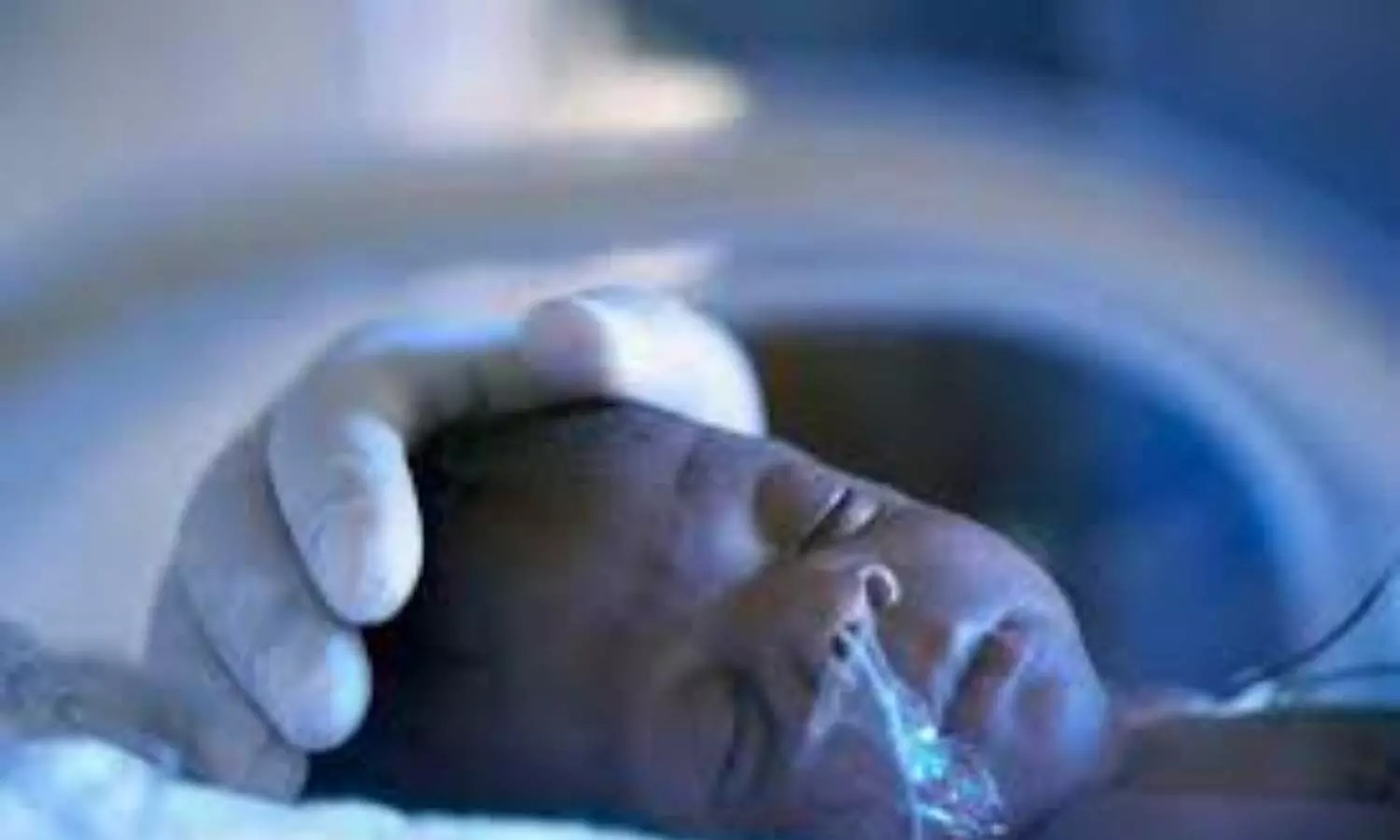 Low-dose steroids reduce time on ventilators and preserve heart in premature infants, study