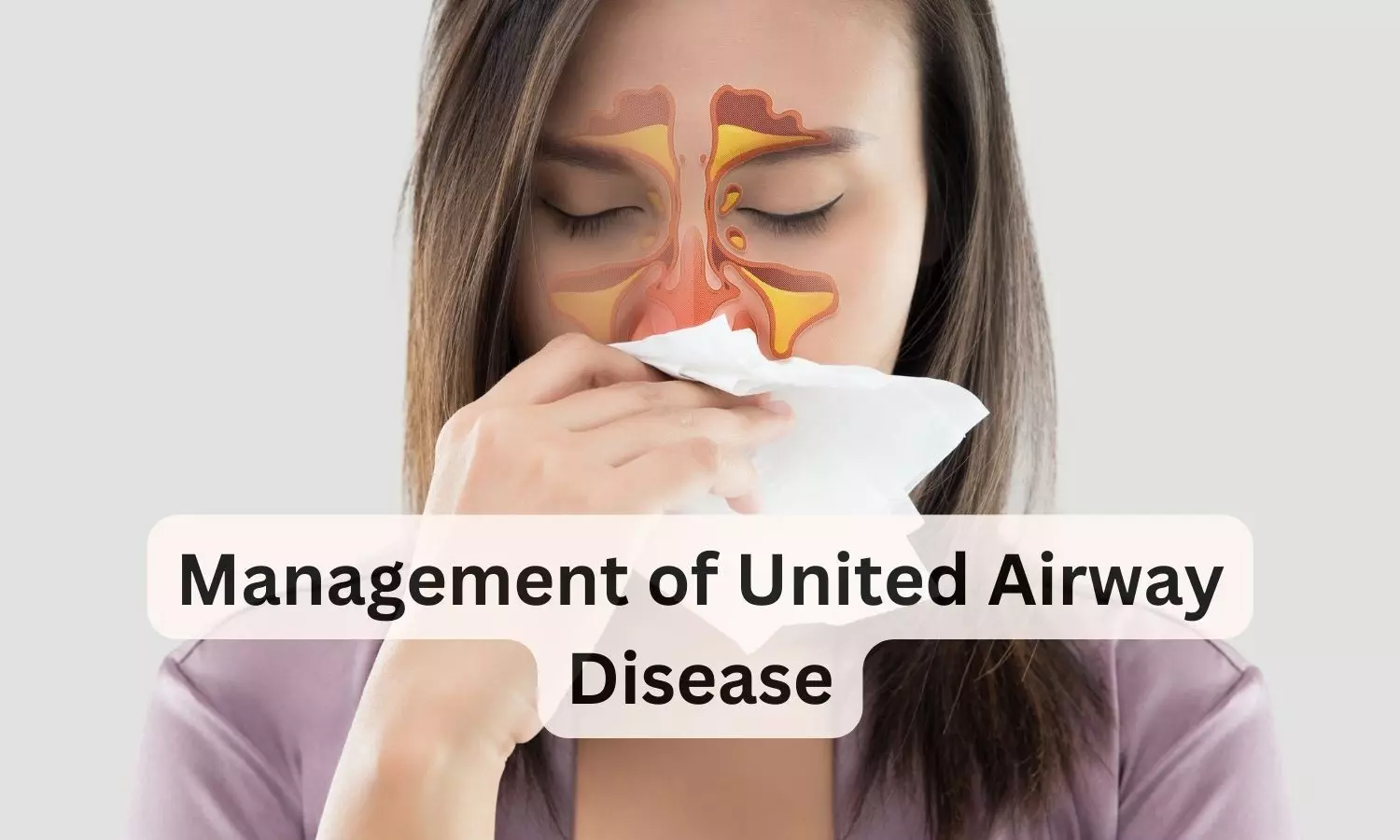 United Airway Disease and Clinical Applicability of Montelukast Fexofenadine Combination: Review