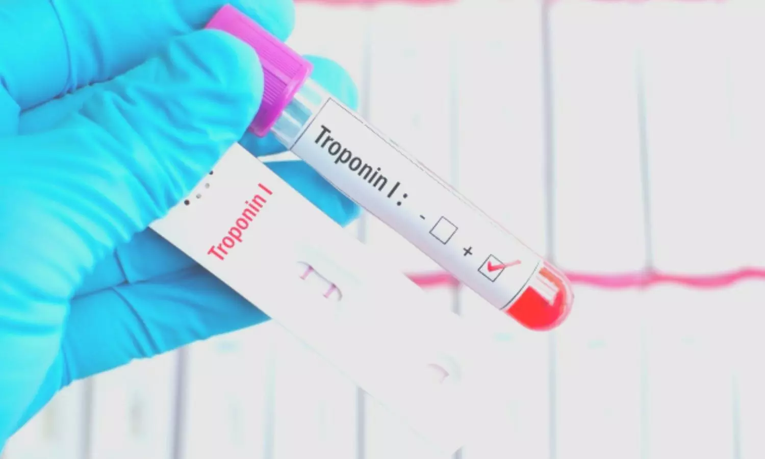 Serial hs Troponin assessment may further refine risk-assessment in patients post ACS: JAMA study