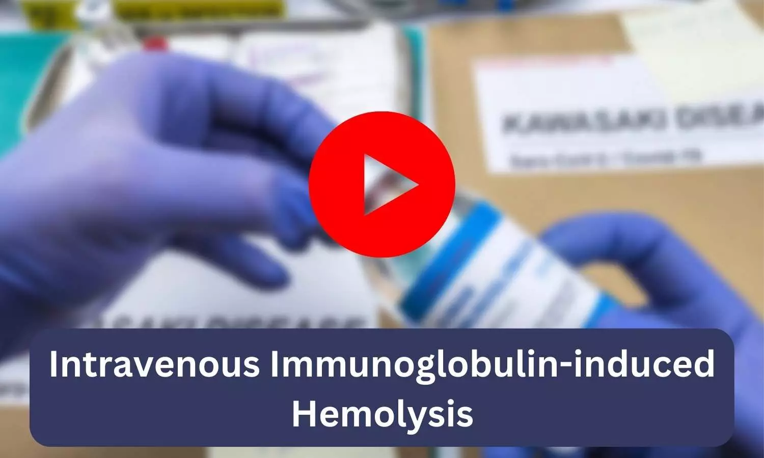 Intravenous Immunoglobulin-induced Hemolysis