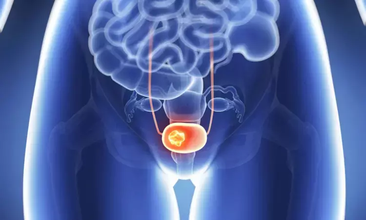 Metabolic syndrome linked with elevated risk of bladder cancer