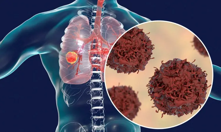 Targeted lung cancer drug repotrectinib shows promise in TRIDENT-1 trial