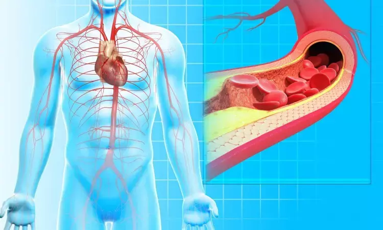 Food insecurity may increase heart risks for people with peripheral artery disease