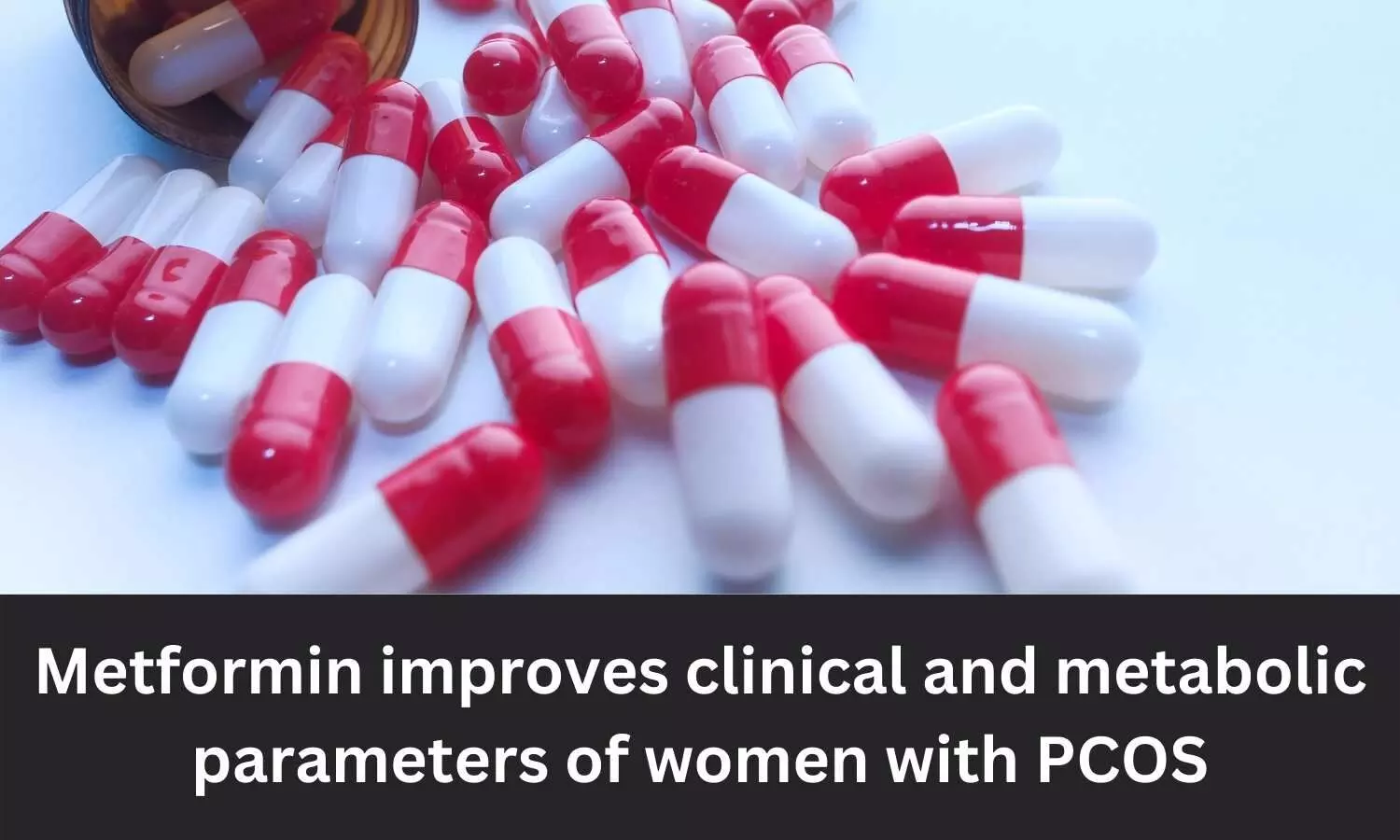 Metformin improves clinical, metabolic parameters of women with PCOS