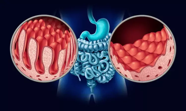Diverticular disease associated with cancer outside gastrointestinal tract