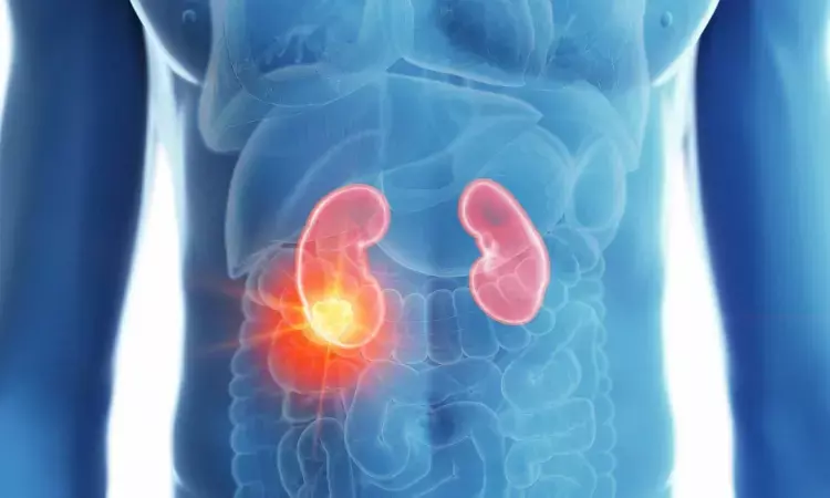Evaluation, Management, and Follow Up of Renal Mass and Localized Renal Cancer: AUA Guideline