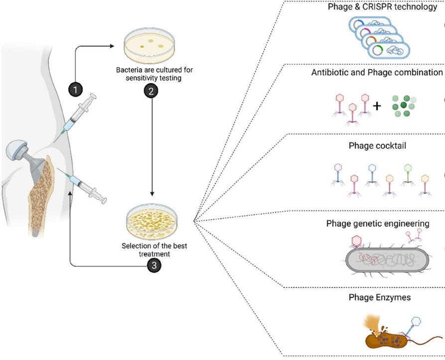 bacteriophage therapy in implant related infections an experimental study