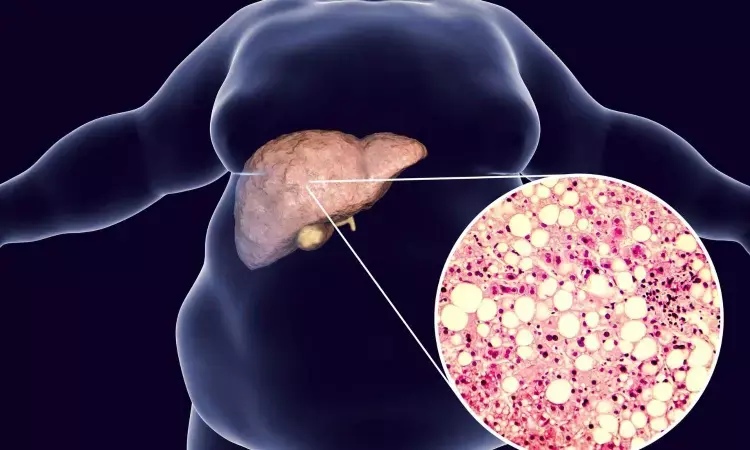 First-degree relatives of patients with NAFLD at risk of developing  liver disease