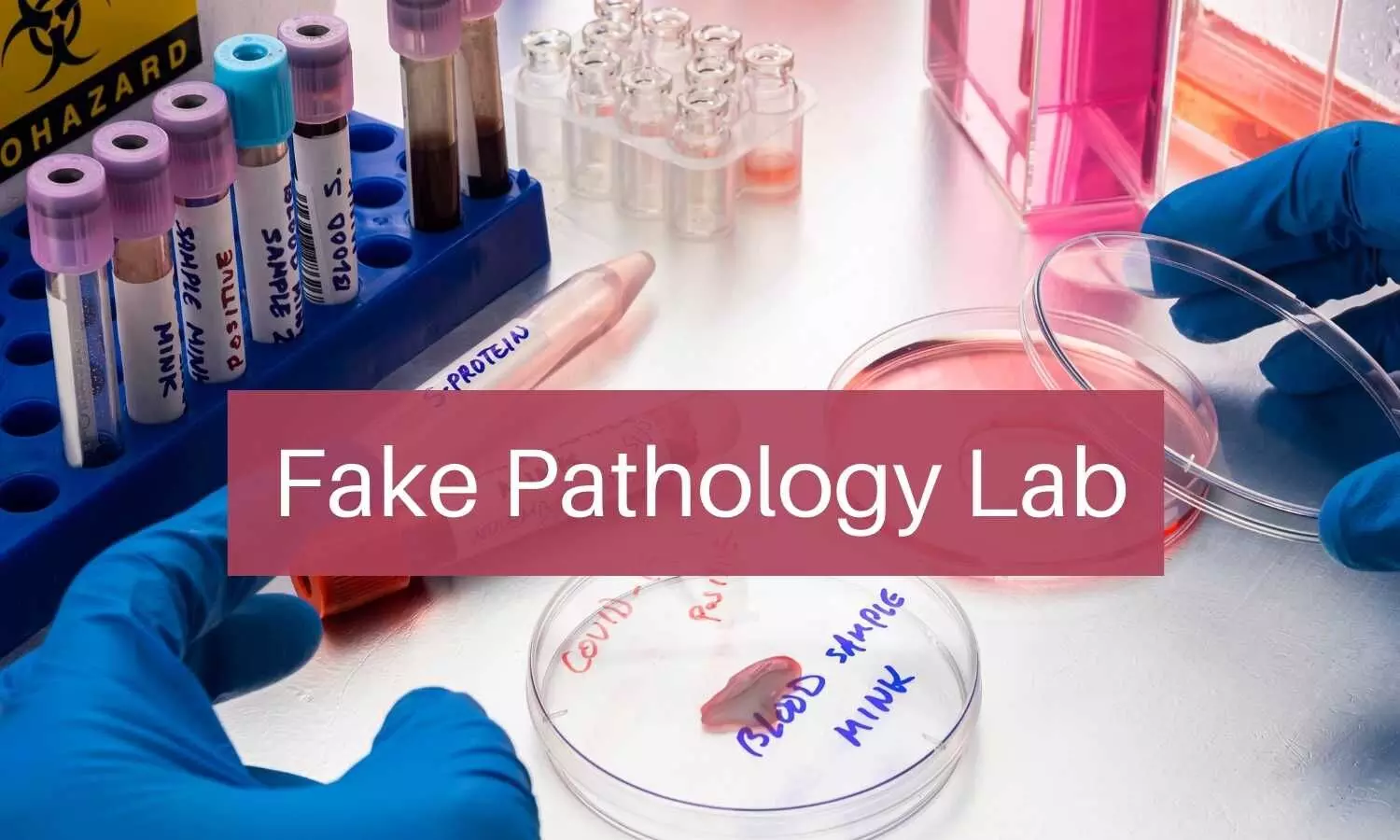 Gurugram: Fake doctor held for running illegal pathology lab