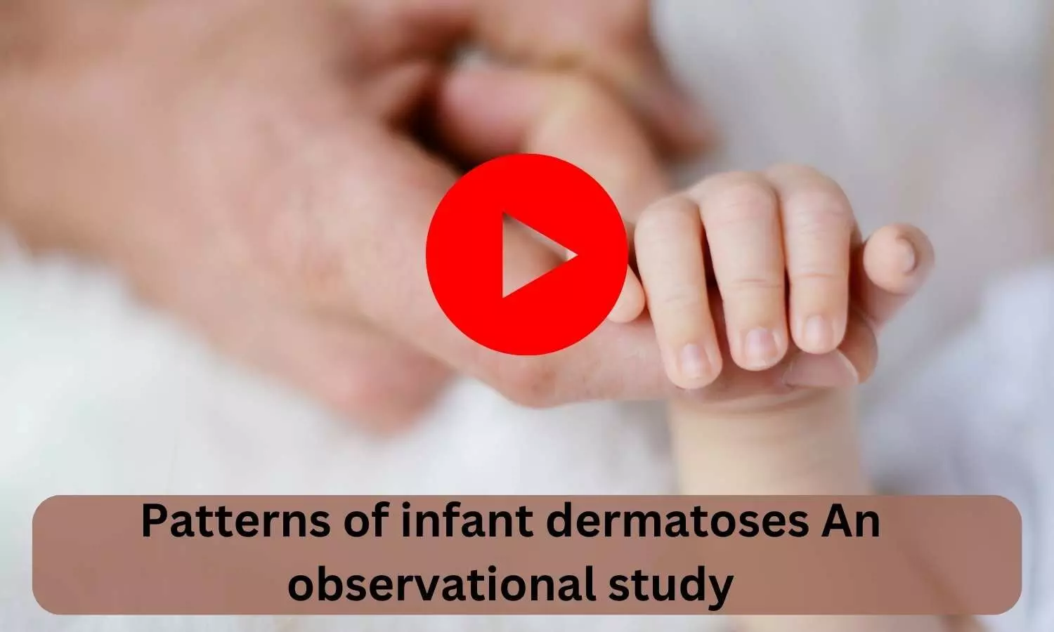 Patterns of infant dermatoses An observational study