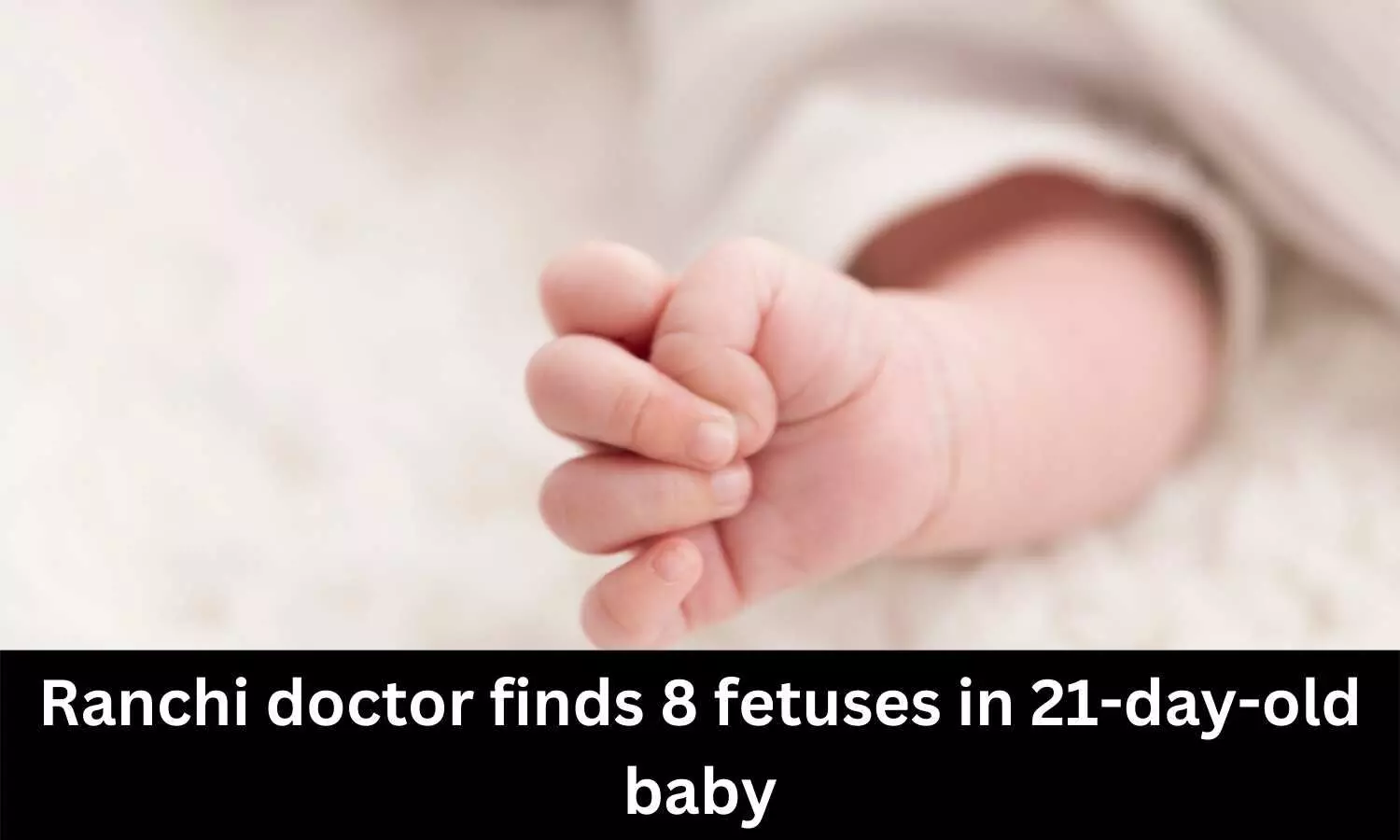 Ranchi: Doctor finds 8 fetuses in 21-day-old baby