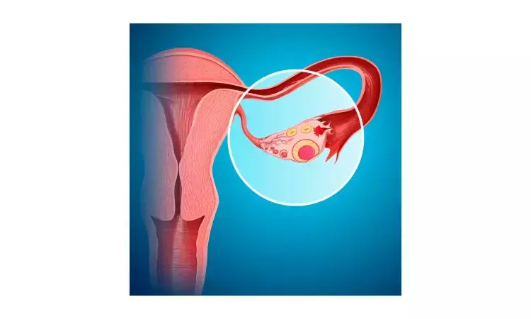Premenopausal removal of ovaries  linked with risk of parkinsonism and Parkinsons disease: JAMA