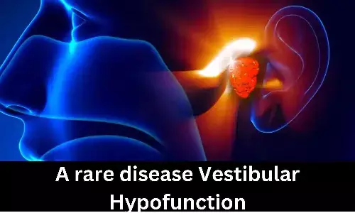 A rare disease Vestibular Hypofunction