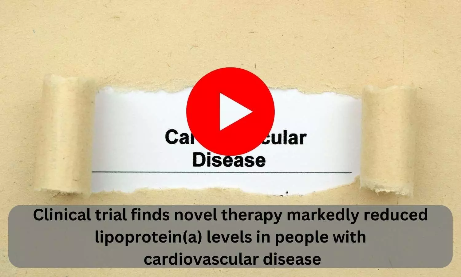 Clinical trial finds novel therapy markedly reduced lipoprotein(a) levels in people with cardiovascular disease