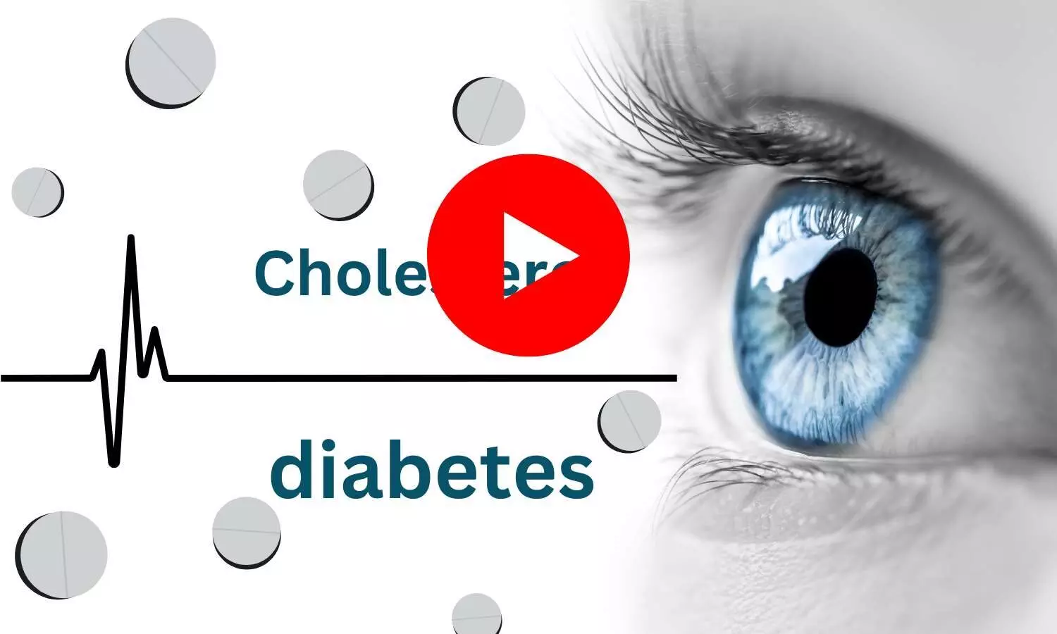 Cholesterol and diabetes drugs may lessen risk of degenerative eye disease of ageing