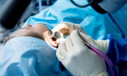 Transcanal endoscopic ear surgery feasible and effective for the removal of Congenital cholesteatoma:JAMA