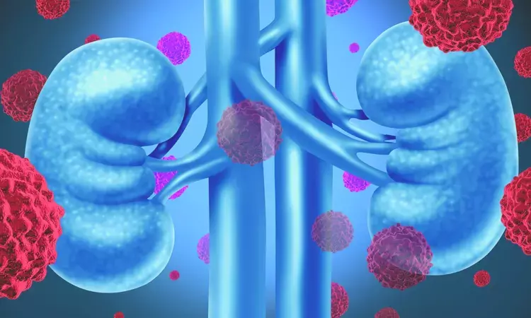 Younger survivors of kidney cancer at greater risk of heart issues