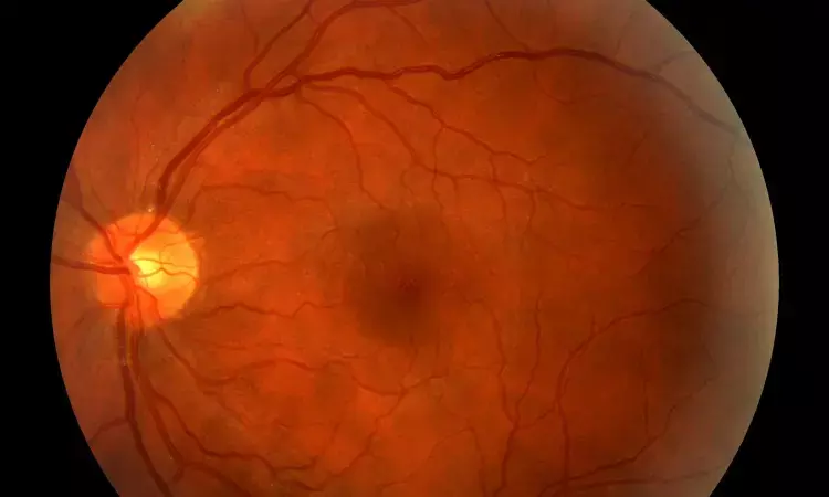 Finerenone prevents progression of non-proliferative diabetic retinopathy: Study