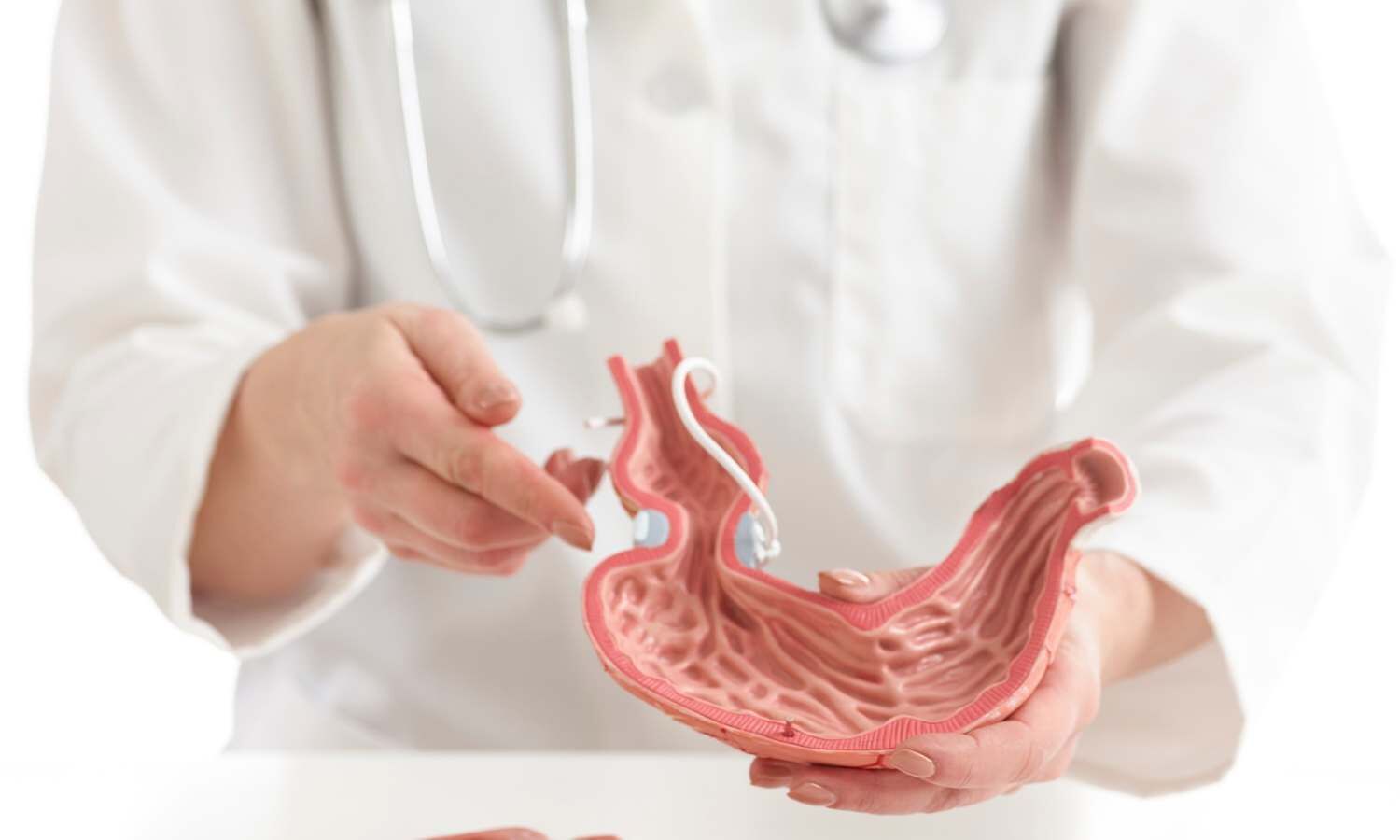 Both gastric bypass and sleeve gastrectomy have similar rates of